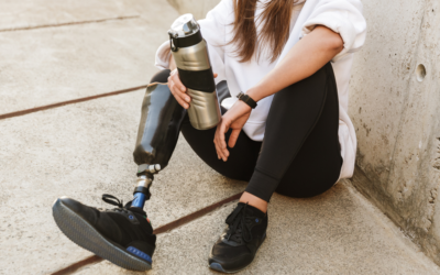4 Ways Bionic Technology is Changing Disability